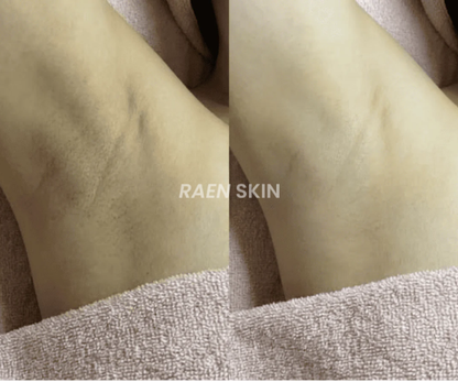 Raen Skin Siero Controllo Ricrescita